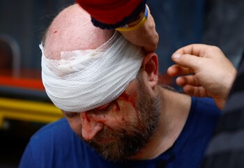 También se denunció el uso