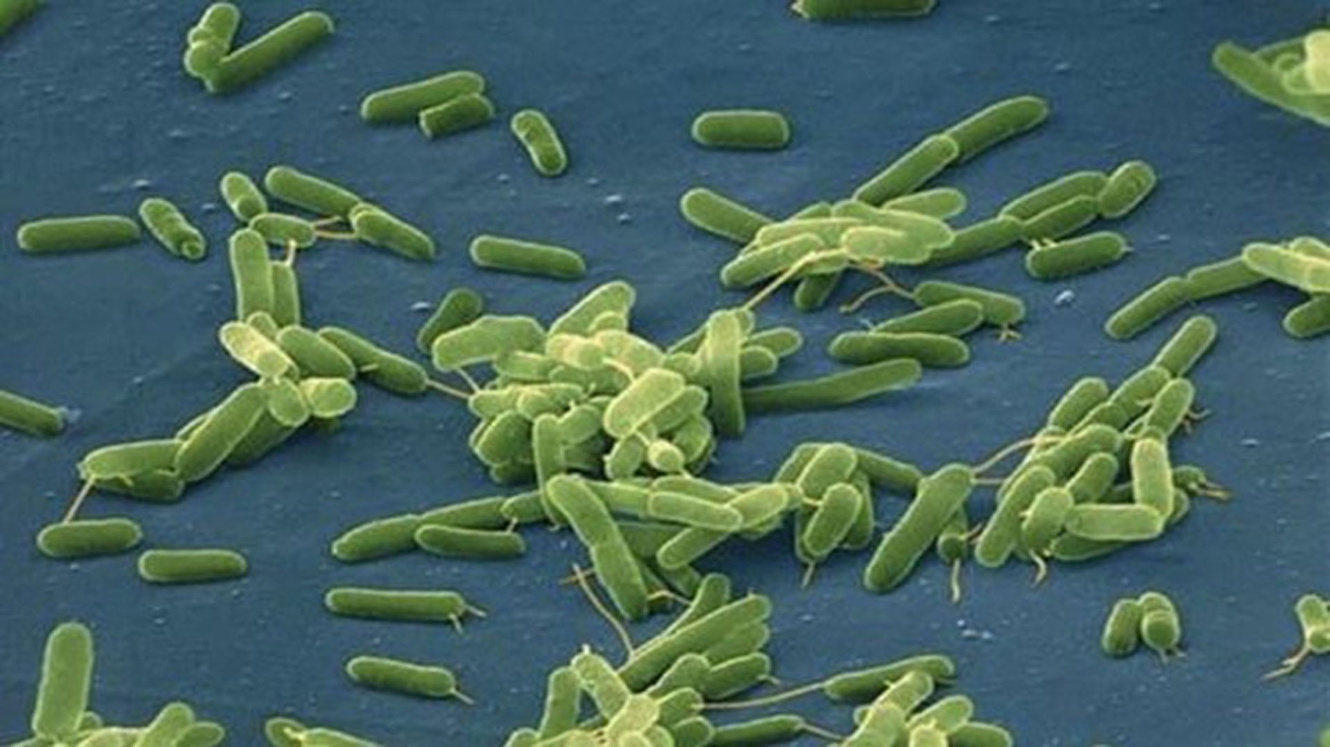 La bacteria 'come carne' representa un riesgo mayor para personas inmunodeprimidas y para pacientes con enfermedad hepática crónica.