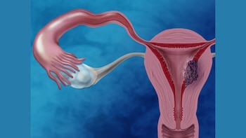 Estos son los 5 principales