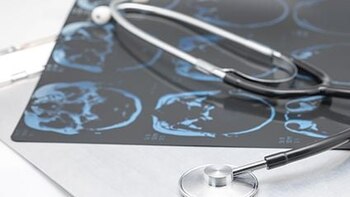 Utilizando escáneres cerebrales, investigadores encontraron