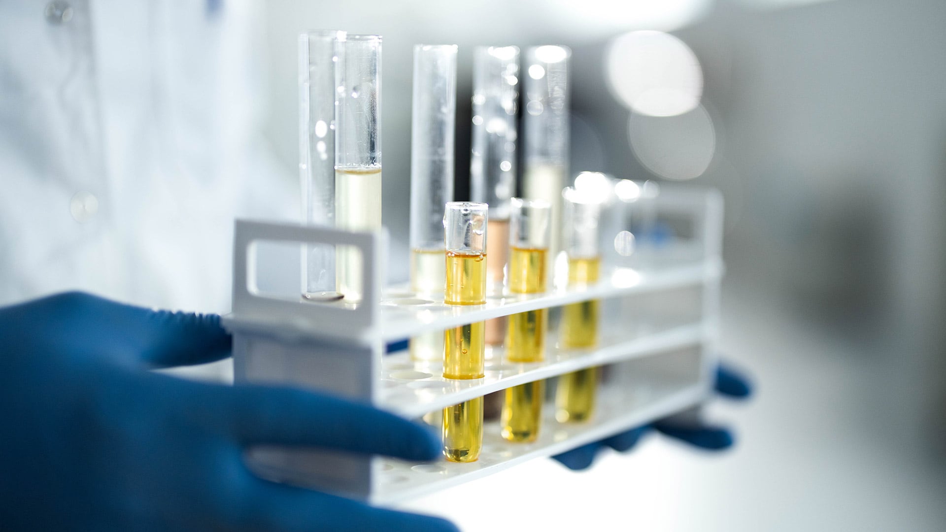El costo económico y la burocracia para obtener medicamentos de alto valor, como el cannabidiol (CBD), aprobado para epilepsias graves, son trabas frecuentes