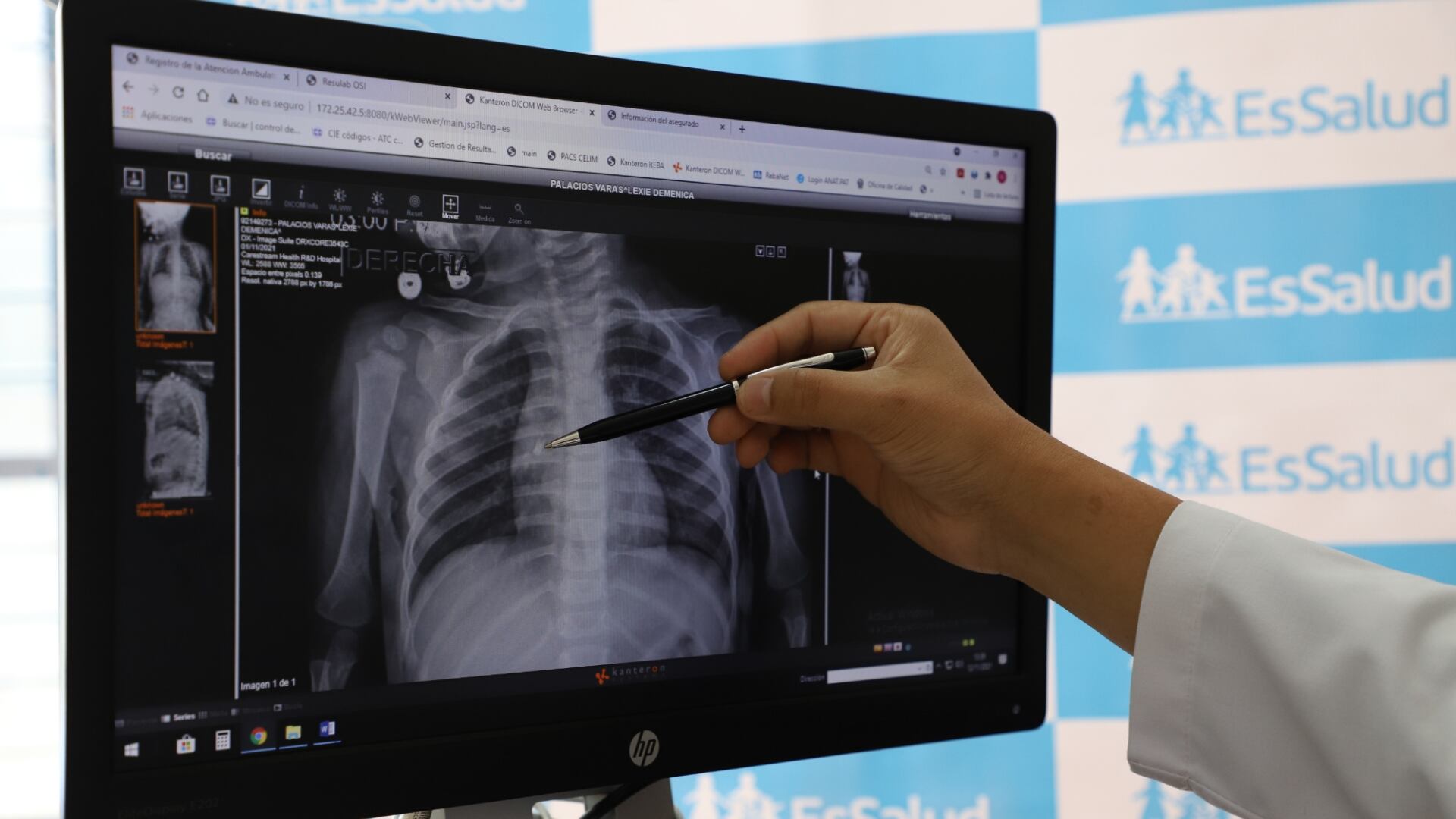 El 100 por ciento de los pacientes internados por influenza en el estudio tenía criterio para vacunarse pero la mayoría no había recibido la dosis (Freepik)