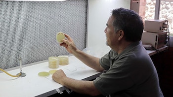 No solo es la Cyclospora: UNAM alerta sobre superbacteria global que afecta a animales y humanos