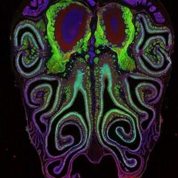 Imagen microscópica vibrante mostrando estructuras entrelazadas en tonos de verde, azul y morado, con puntos rojos dispersos sobre un fondo negro