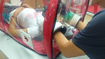 La cápsula prmite la intubación