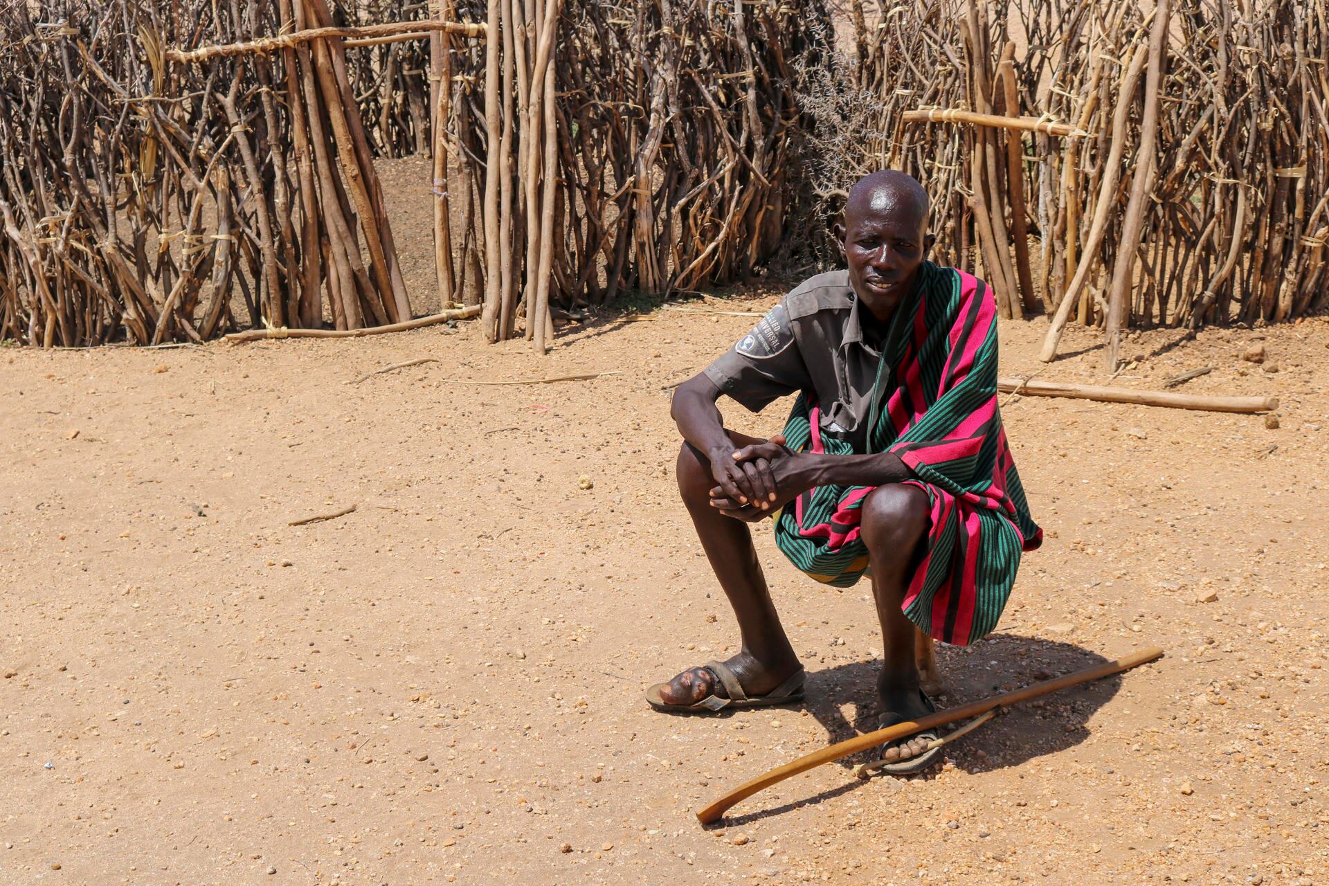 El micetoma es una enfermedad tropical desatendida que, frente a la falta de investigación y fondos, devasta la vida de un número desconocido de habitantes del condado más pobre de Kenia, Turkana. -EFE/ Lucía Blanco