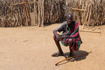 El micetoma es una enfermedad