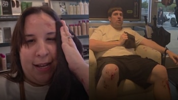 Una mujer sostiene una toalla junto a su rostro y un hombre se encuentra sentado en un sillón con sangrado visible en las rodillas