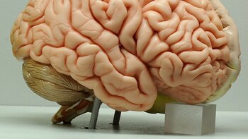 What happens in the brain