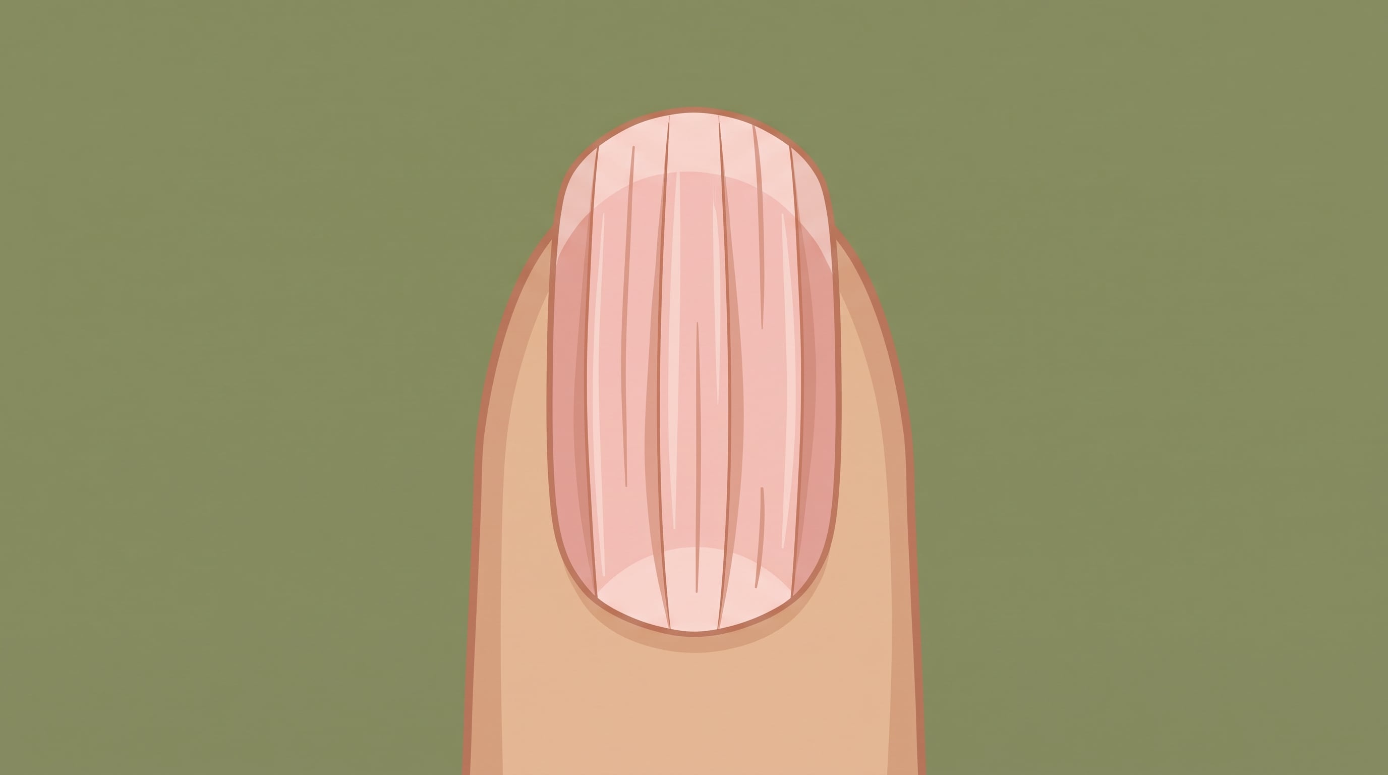 Las uñas rayadas pueden reflejar cambios en la piel, la alimentación o el estado general del organismo (Imagen Ilustrativa Infobae)