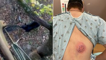 Así quedó la espalda del