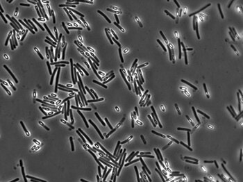 13/07/2017 Clostridium difficile
ESPAÑA EUROPA MADRID