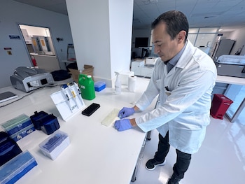 PRUEBA PERMITE DETECTAR HASTA 9