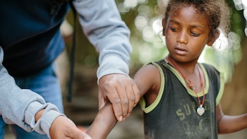 La lepra tiene cura: el