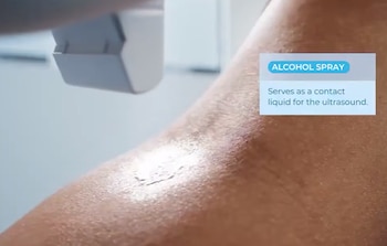 Brazo robótico - robot - sangre - tecnología - 2 de septiembre