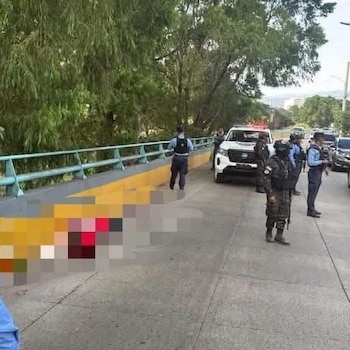 Inicialmente se manejó la hipótesis de un posible atropellamiento, debido a una marca similar a la huella de una llanta en uno de los brazos de la mujer. (Foto: Cortesía / redes sociales)