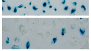 Descubren que un compuesto derivado