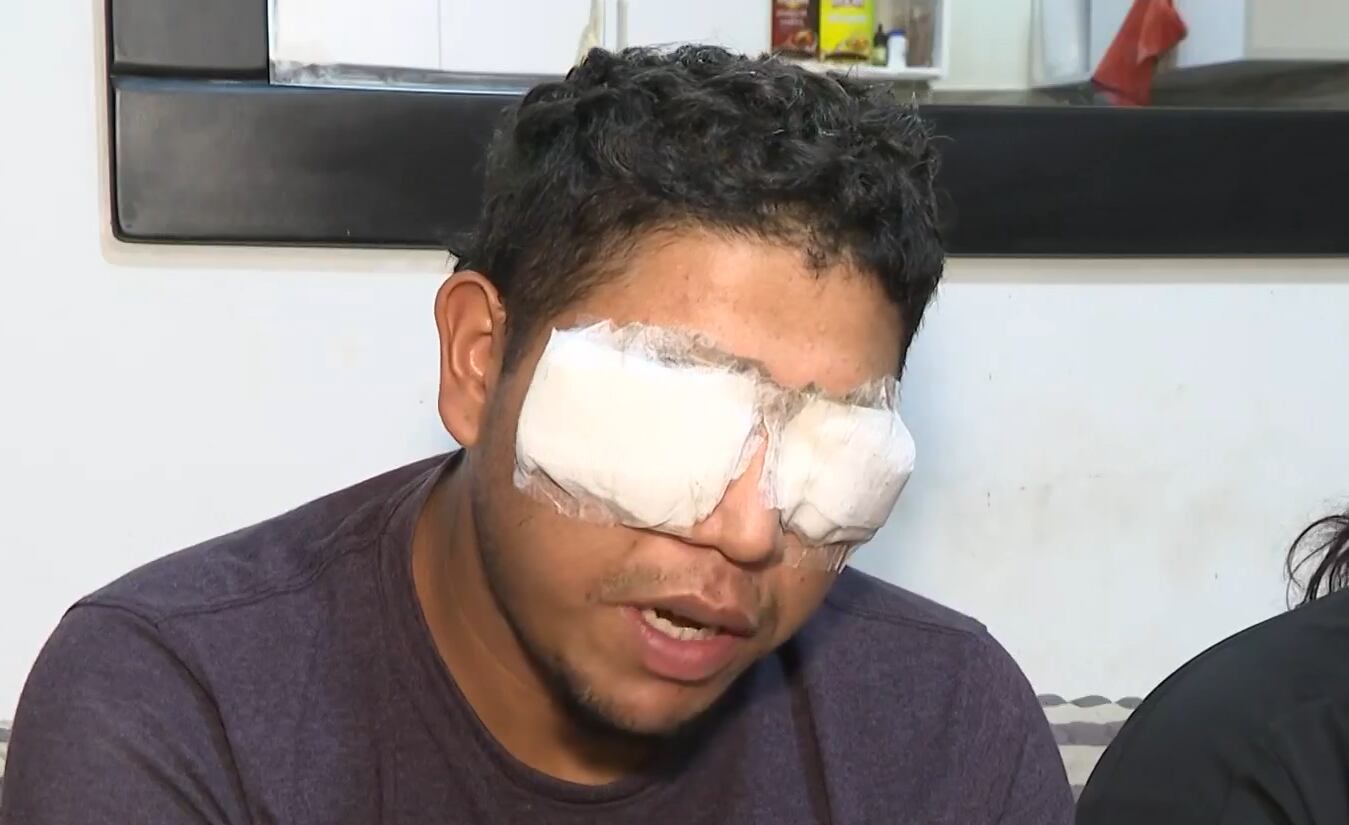 La familia de Zamudio enfrenta graves problemas financieros debido a los elevados gastos médicos y la necesidad de atención especializada, además de tener tres hijos pequeños