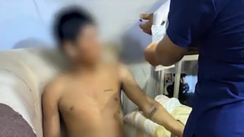 Joven herido permanece grave tras presunto error de diagnóstico en hospital Loayza. (Foto: Captura video/Panamericana)