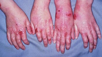 El gel que podría ser