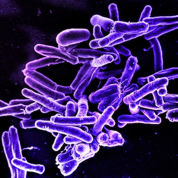 También se investiga el desarrollo de nuevas vacunas para la tuberculosis/NIAID