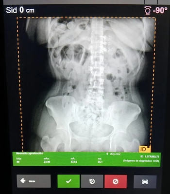 Detenidas por trasladar cocaína en