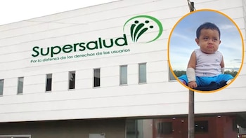 Supersalud confirmó la entrega de medicamentos a Elian, bebé con ‘piel de mariposa’, en Guainía: podría perder un ojo si no recibe tratamiento