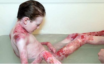 El gel pasó dos rondas