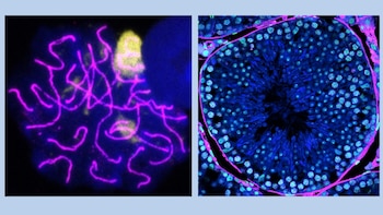 Espermatocito (izquierda) y túbulo seminífero de ratón (derecha) visualizados por microscopia de alta resolución. (UAB)