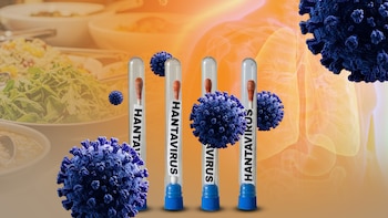 Qué comer para reforzar tu sistema inmunológico ante el brote de hantavirus: lista de frutas, verduras y líquidos
