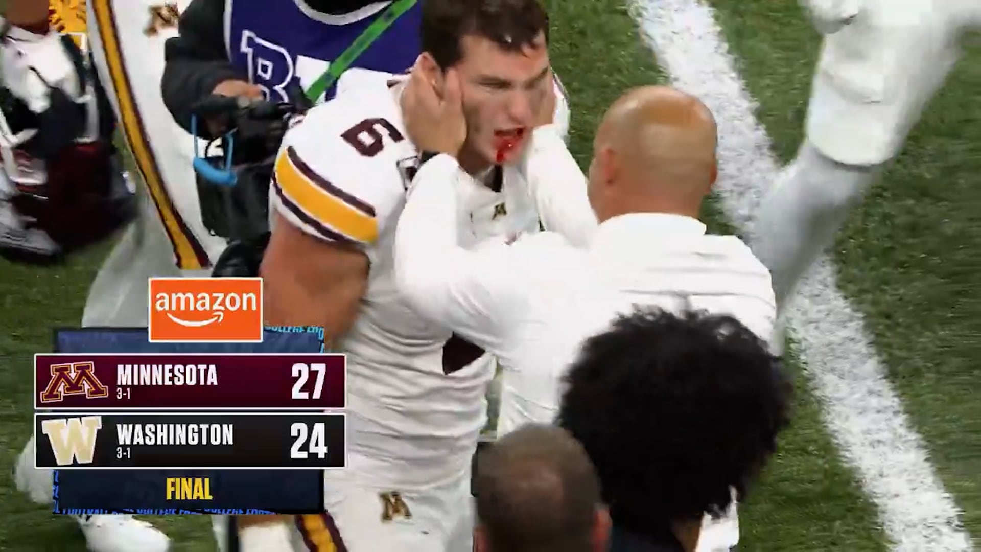 Un entrenador de fútbol americano sostiene el rostro de un jugador con sangre en la boca tras finalizar el encuentro entre Minnesota y Washington.