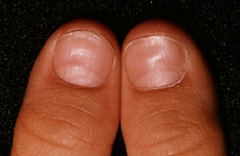 Esta forma peculiar en las