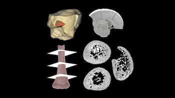 Reconstrucción 3D de hueso y fragmento de fémur con sus cortes transversales en escalas de grises sobre fondo negro