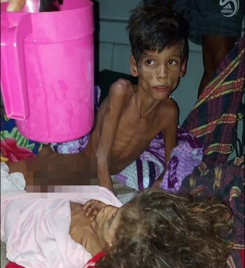 Los niños perdieron mucho peso