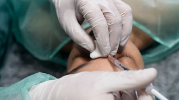 Quitarse la vena de la frente, la última moda en operaciones estéticas que encierra riesgos para la salud