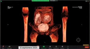 Las presuntas tomografías que se