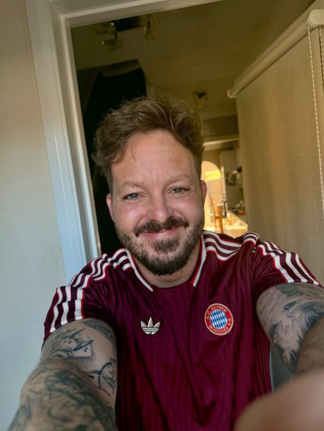 La neurofibromatosis tipo 2 puede pasar inadvertida cuando síntomas como sordera, debilidad en las piernas o falta de coordinación se confunden con el envejecimiento (Michael Archer Instagram)