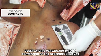 Masacre de Macuto - Operación