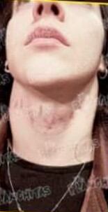 Vaquer muestra las marcas de violencia que le dejo el luchador, Cuatrero.