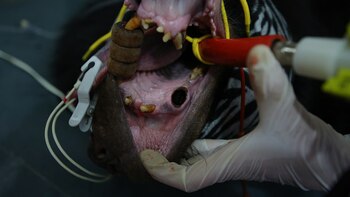 Xuan tiene algunos dientes destruidos