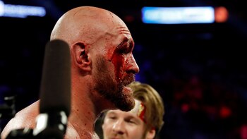 Tras su pelea con Wallin