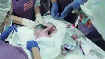 Una imagen de las siamesas