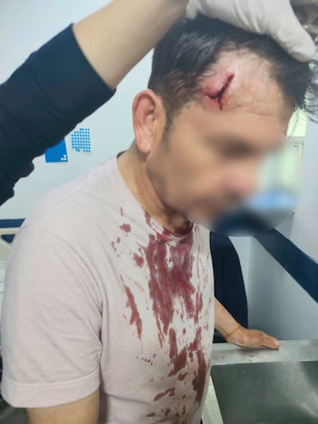 La víctima fue sorprendida en cuestión de segundos, según las imágenes del ataque - crédito Pasa en Bogotá/X