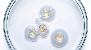 Plato de Petri de cristal, líquido blanco, tres formaciones circulares con núcleos translúcidos amarillos y ámbar rodeados por halos blancos, burbujas pequeñas.