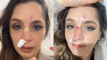 Yiddá Eslava se rompe la