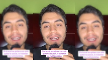 Gabriel Aedo, dermatólogo: “Si el