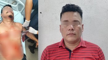 'El Golpes' recibió tres impactos