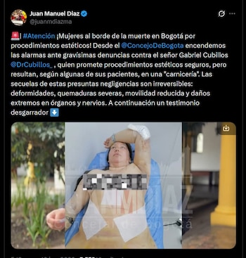 O vereador Juan Manuel Díaz alertou o Conselho de Bogotá sobre as inúmeras denúncias contra Gabriel Cubillos da Clínica Obesidade e Idade - crédito @juanmdiazma /