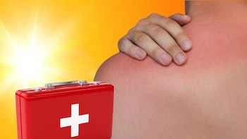 Primeros auxilios: ¿Qué hacer en