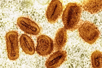 La OMS señaló que la mpox es una enfermedad por Orthopoxvirus y que la identificación temprana ayuda a limitar la propagación de los brotes. (NIAID vía AP, Archivo)